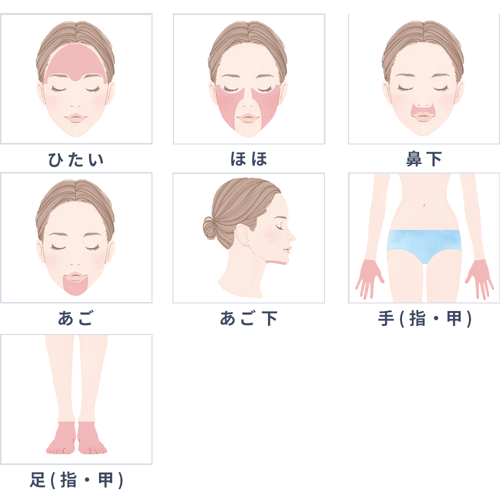 部位ごとの照射範囲（Sパーツプラン）