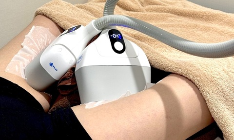 脂肪冷却の腿の施術シーン