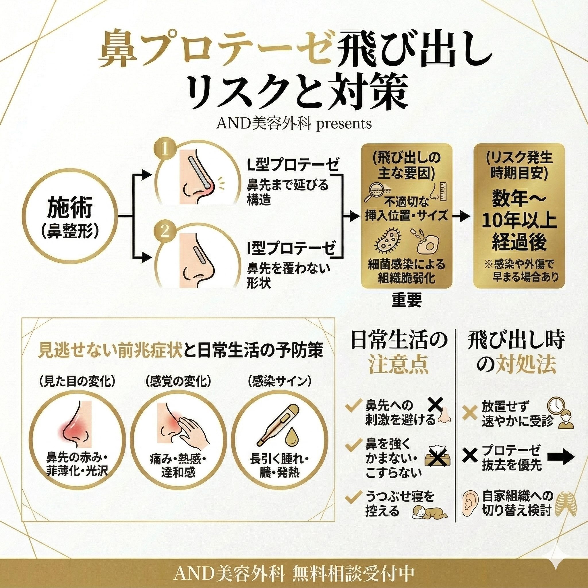 鼻プロテーゼ飛び出しのインフォグラフィック