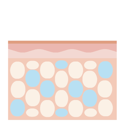 脂肪冷却の仕組み