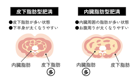 皮下脂肪型肥満と内臓脂肪型肥満の違い