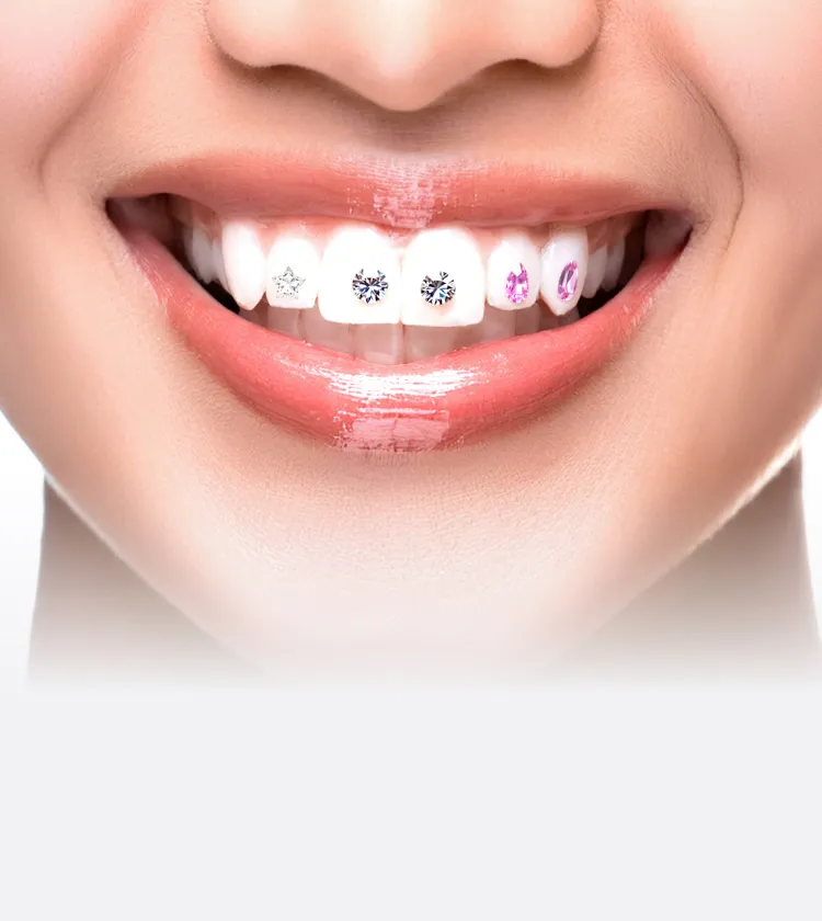 ティースジュエリー