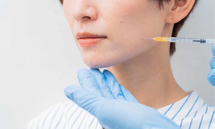 ヒアルロン酸注入