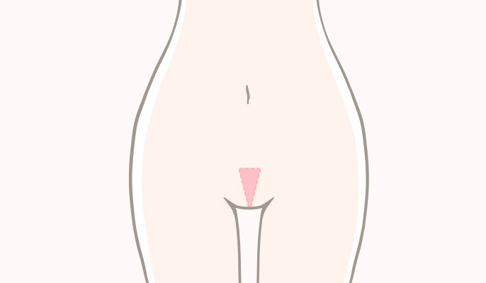 トライアングル