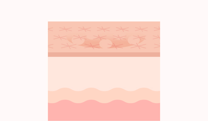 フラクショナルレーザーの施術説明3