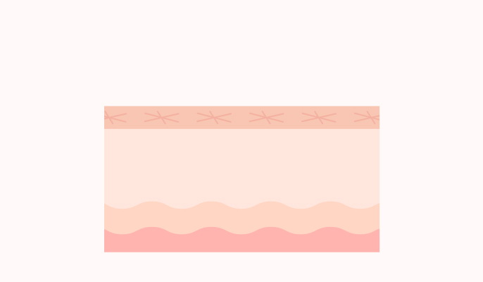 ダーマペンの施術詳細3