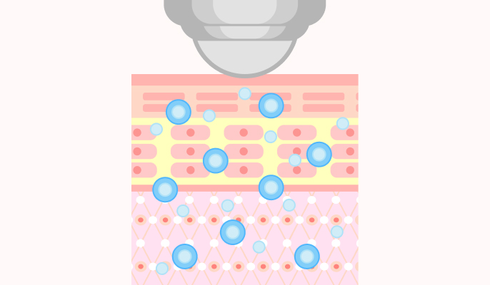 エレクトロポレーションの施術説明