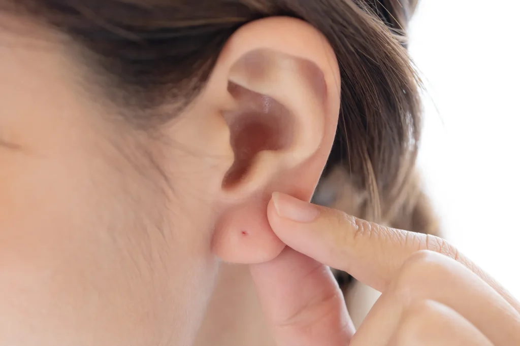 ピアスの穴あけの施術説明