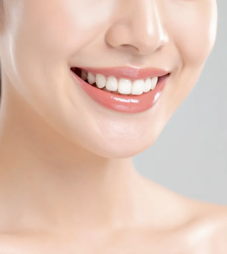 セラミックインレー