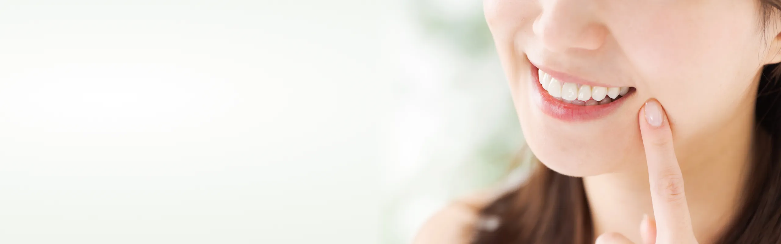 ダイレクトボンディング