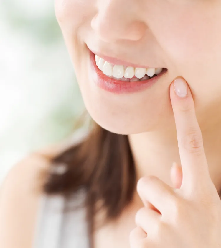 ダイレクトボンディング