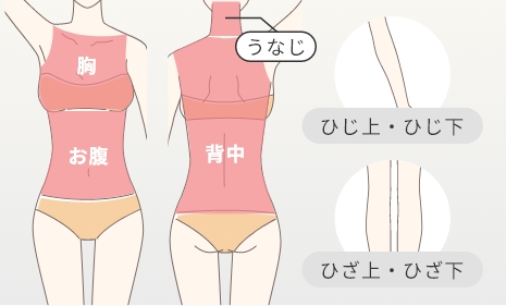 Lパーツプラン