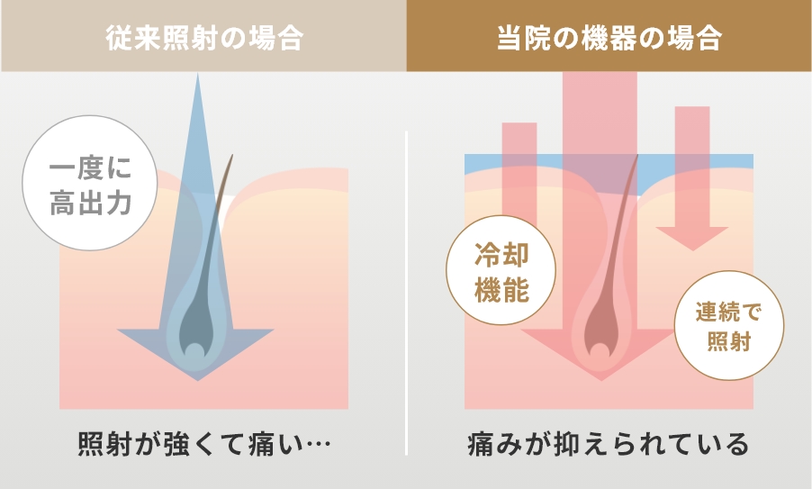 2種類のレーザーで効果を発揮