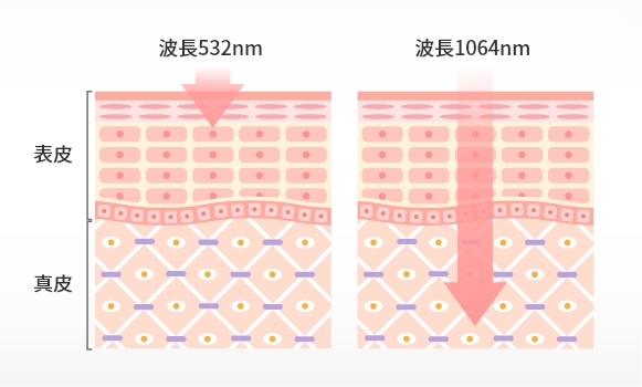 2つの波長でさまざまな治療