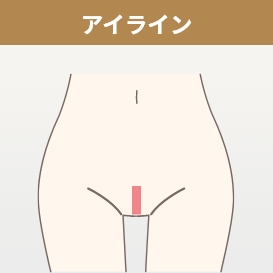 Iライン