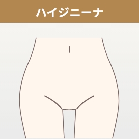 ハイジニーナ